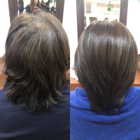 ビフォーアフター