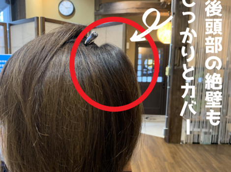 後頭部の絶壁もしっかりとカバー