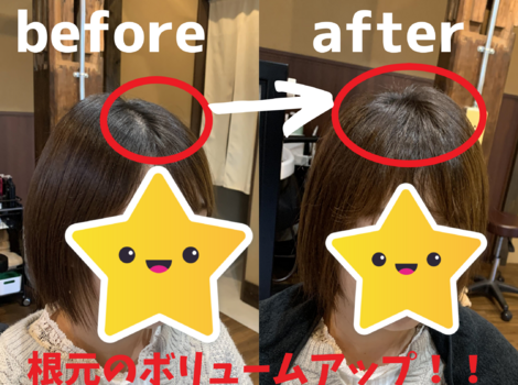 before (1)